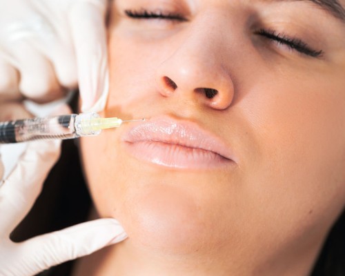 Orvos esztétika Orvos esztétika